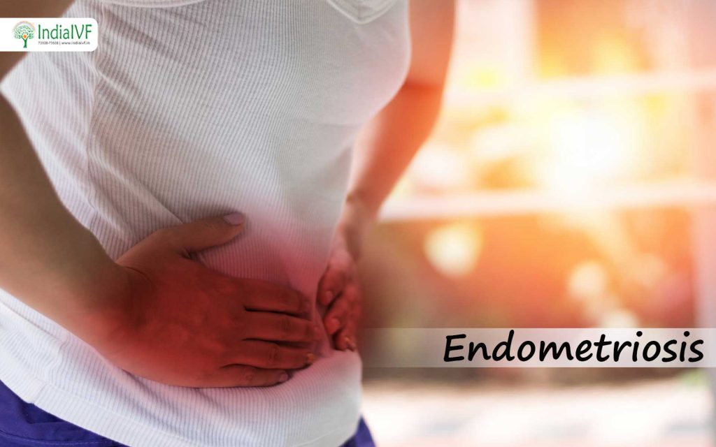 Endometrosis