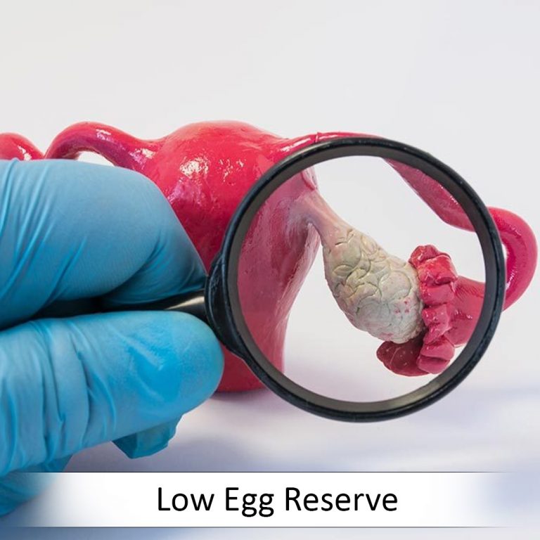 Low Egg Reserve