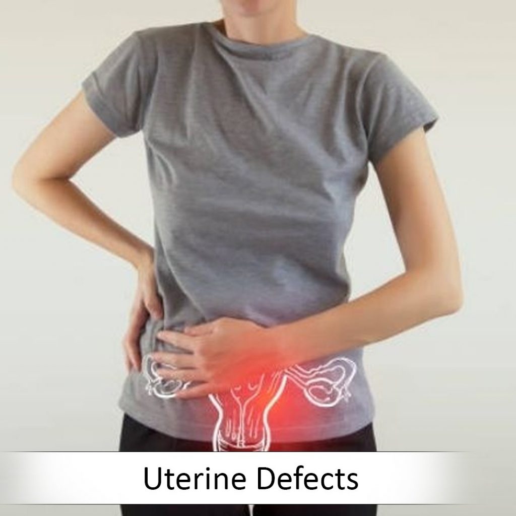 Uterine Defects