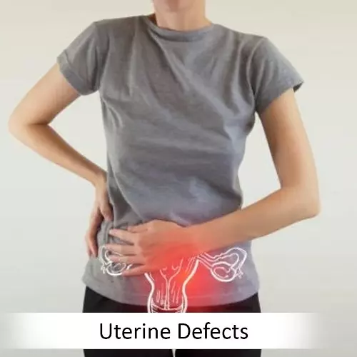 UterineDefects